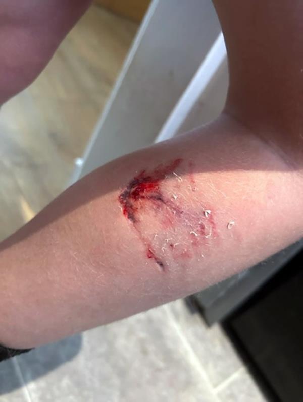 16/10/2023 Picture Alan Simpson 07825 811953 Copy Edinburgh Reporter A seven-year-old boy was attacked by a ?pit bull? type of dog and was bitten on the leg and side while playing in a park near his Edinburgh school. Reece Munro was with his mother, Cheryl, playing in Craigentinny Park Playground near Loganlea Drive when he was attacked twice by the dog. His mother fears he will be left with scarring o<em></em>nce the wounds heal and is co<em></em>ncerned a<em></em>bout the safety of Reece and his friends while out playing. Police Scotland are aware of the incident, which happened on 12 October, and The City of Edinburgh Council dog warden is looking into the circumstances of the attack.